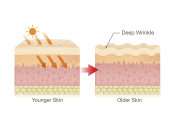 sunlight makes sagging skin.